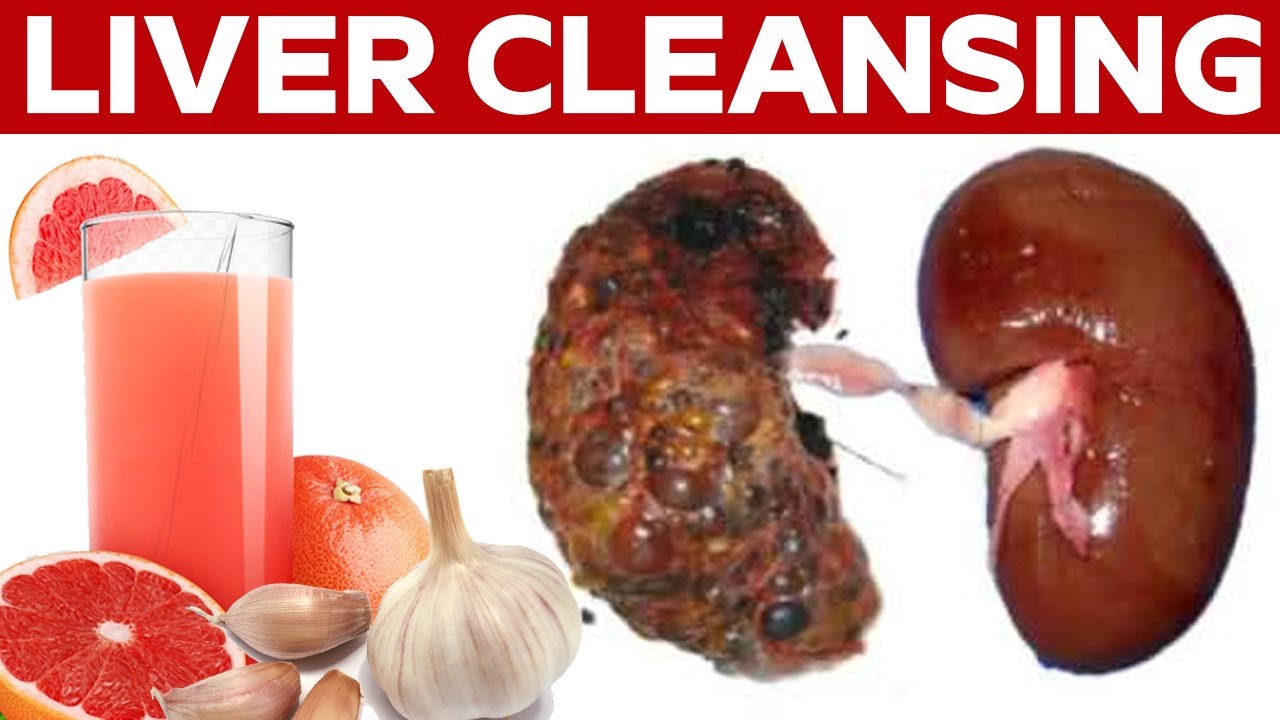 Cleansing Toxins – Protect Your Liver With A Cleanse