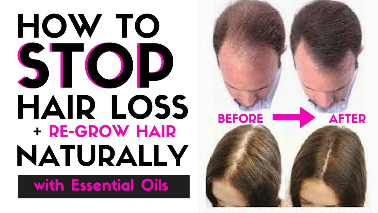 Great Loss Of Hair Tips From The Professionals
