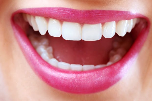 Teeth Whitening, The Plain Truth