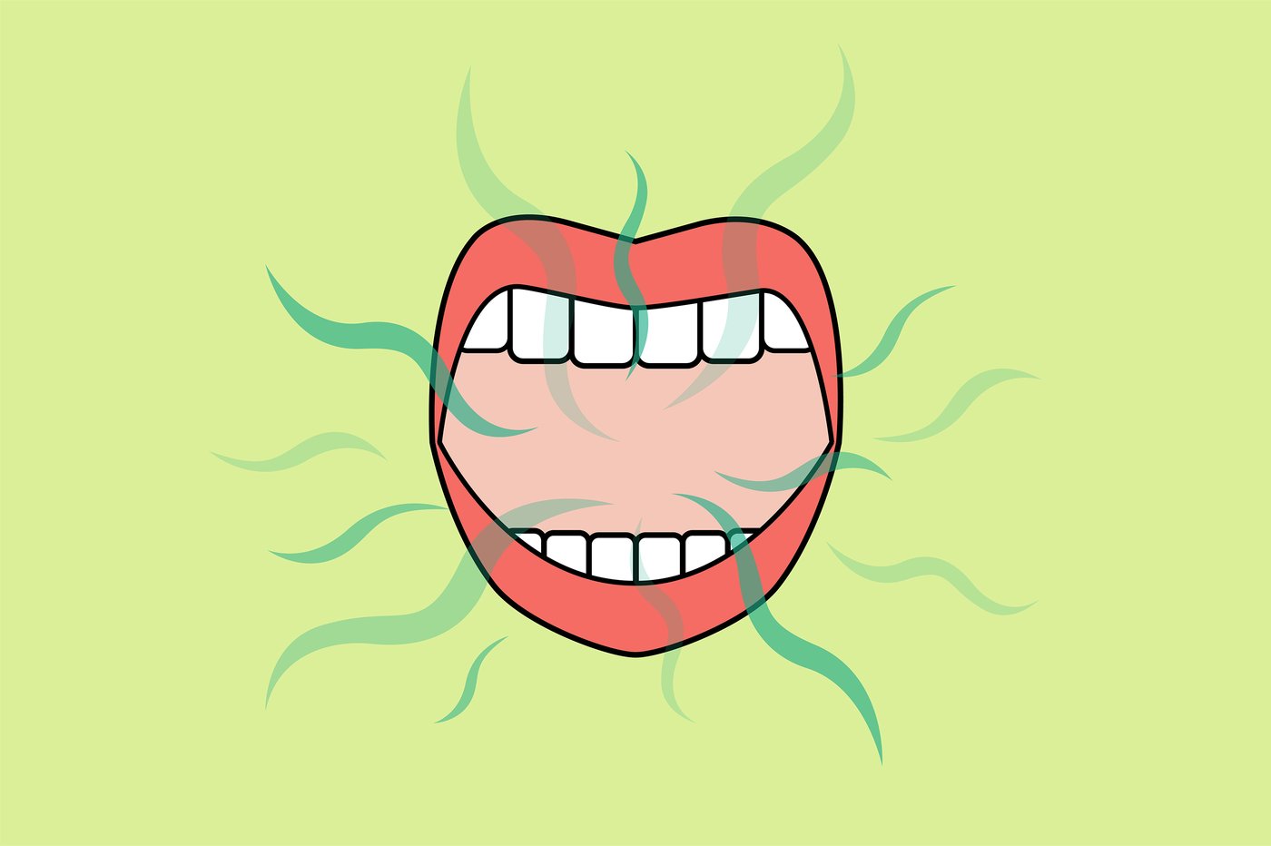 Causes of Bad Breath: What Are They?