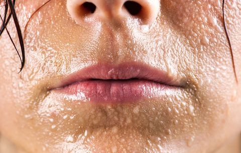 Skin Care – Do You Sweat Excessively?