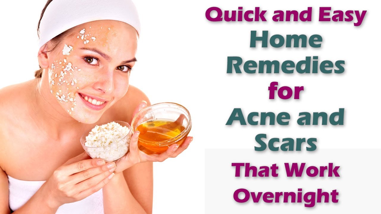 Home Treatment for Acne