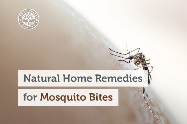 Natural and Herbal Remedies for Mosquitoes
