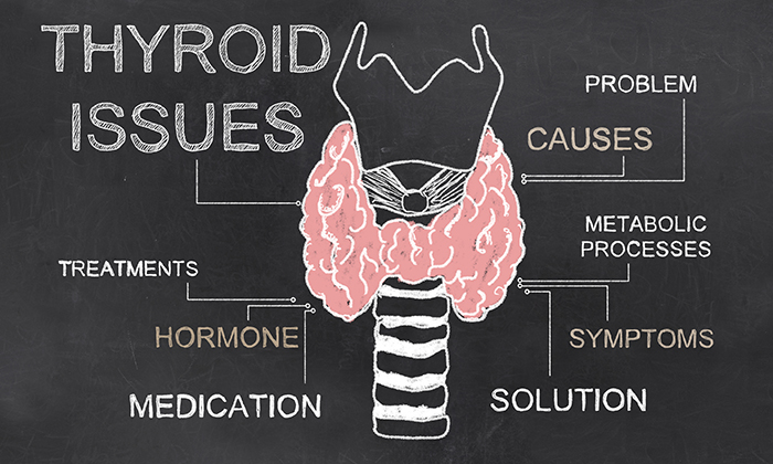 Hypothyroidism – Creating Metabolism Problems